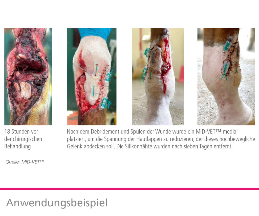 Anwendungsbeispiel_MID-VET-Gewebe-Expander-tapmed